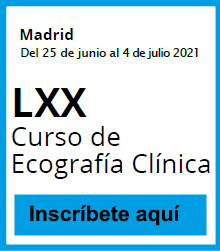 Actividad 32